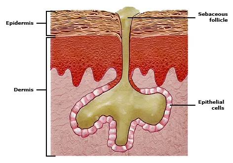 Excessive_sebum_PI