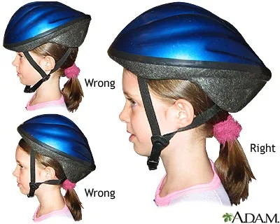 Usar capacete é o maior mico?
