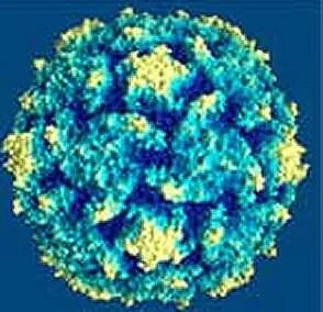 Mononucleose infecciosa