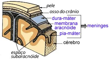 Meningite